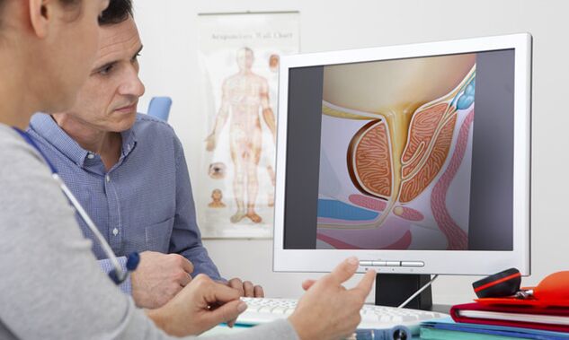 Vedere un medico se c'è una secrezione patologica dal pene